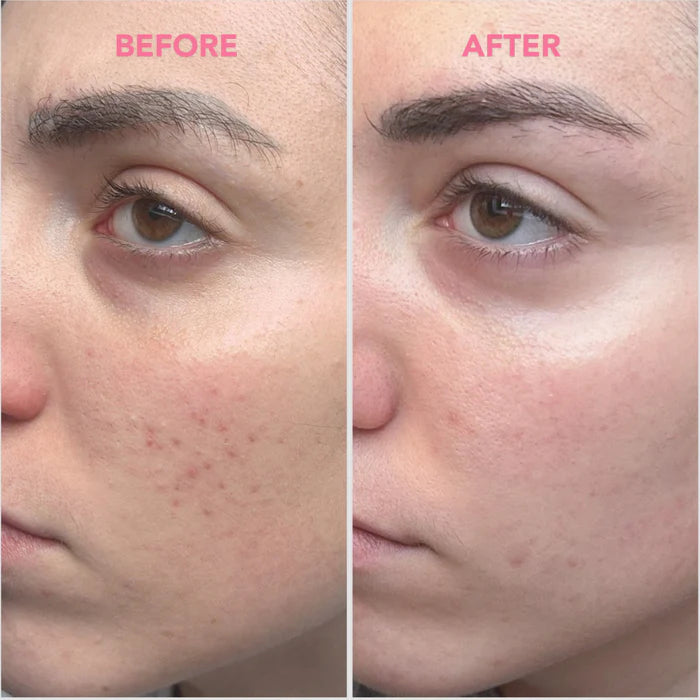 Tea Glow Blemish Cream - Crema viso idratante anti-imperfezioni