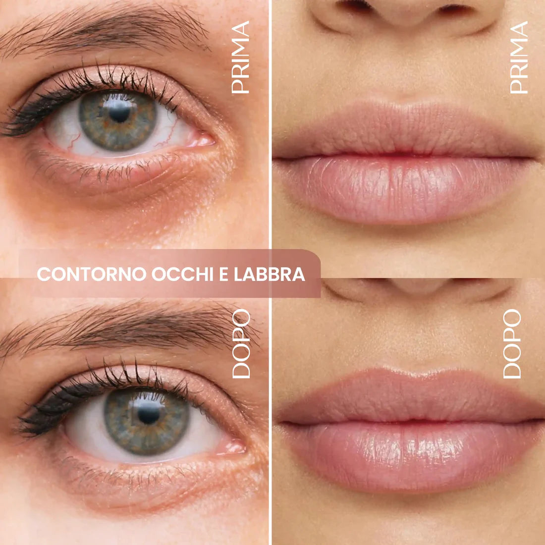 Contorno Occhi e Labbra Rimpolpante